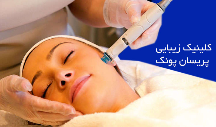 لیزر اکس کندلا در پونک